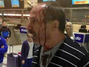 Köln-Bonn Havalimanı'nda polis şiddeti!